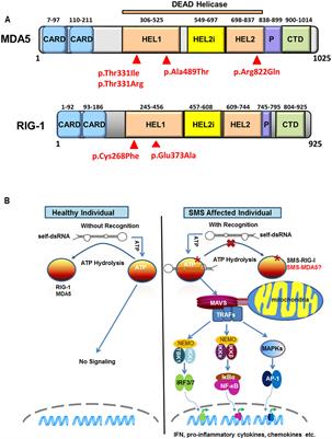 RIG-I-Like Receptor Signaling in Singleton-Merten Syndrome